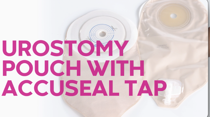 Application of Urostomy Pouching System with Accuseal Tap