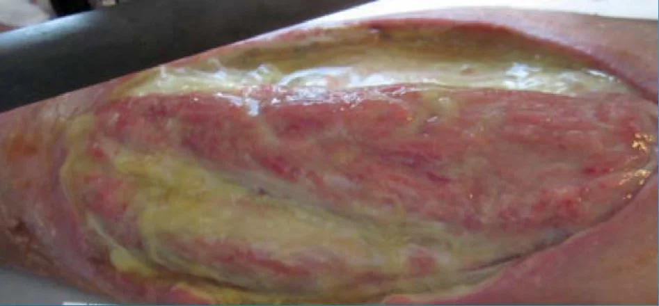 una sartén de comida